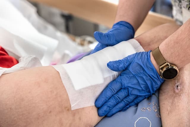 Bedsores in Nursing Homes: A Sign of Neglect and Preventable Harm